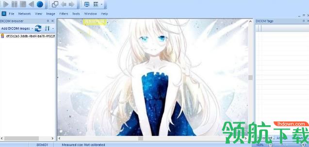 MicroDicom viewer官方版