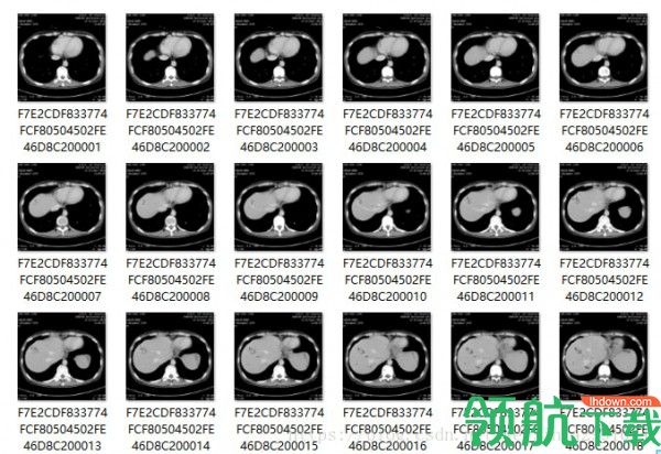 MicroDicom viewer官方版
