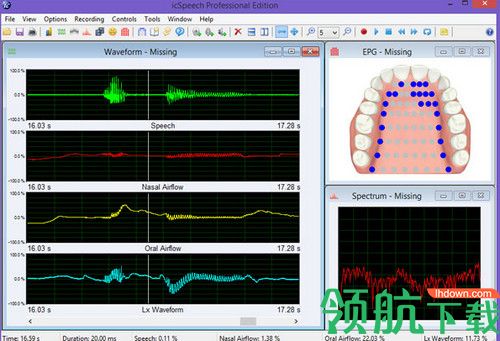 RoseMedical icSpeech Pro破解版